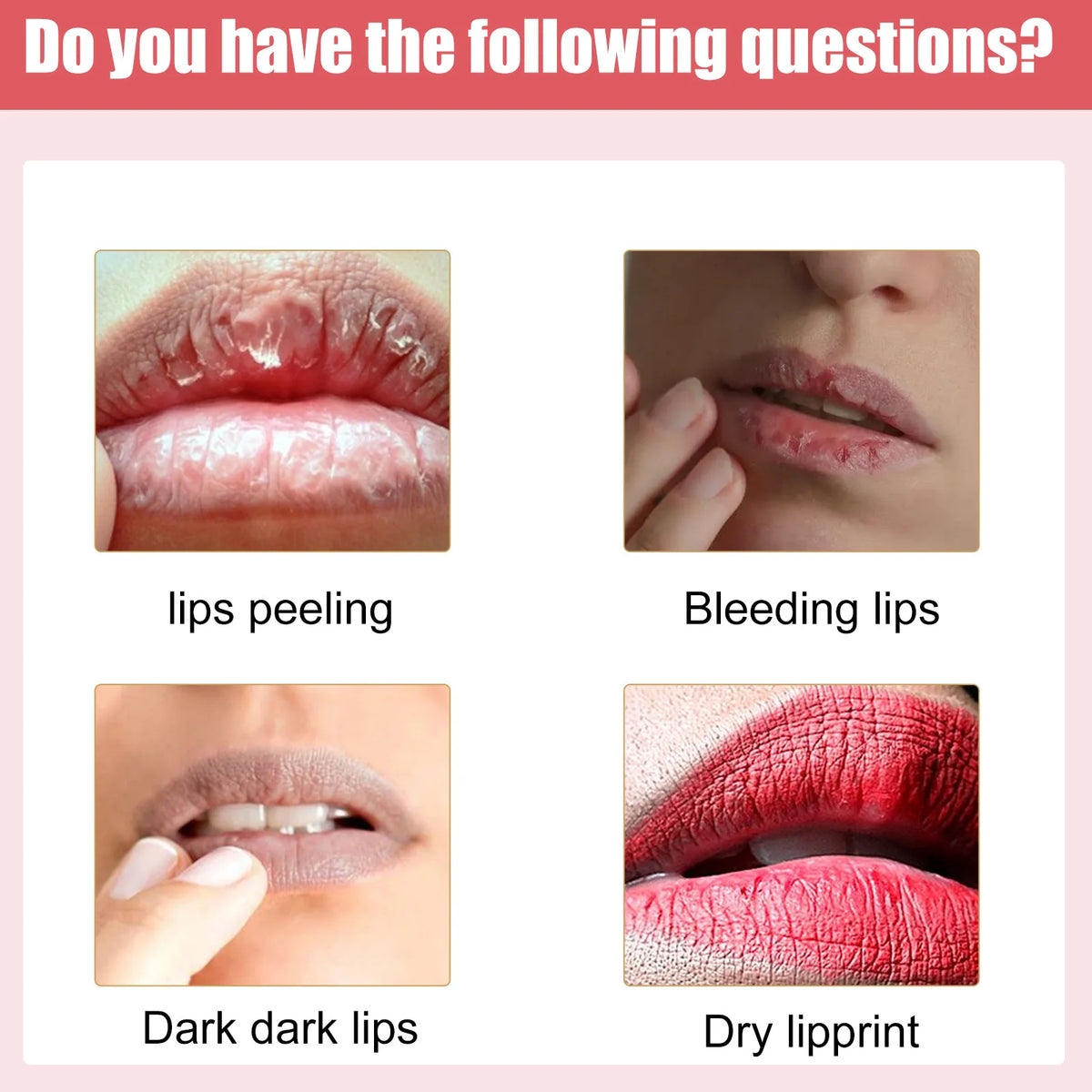 Vitamin E Pink Lip Lightening Cream Dark Melanin Lip Remover Moisturizing Brightening Dead Skin Repair Soften Lips Color Cream